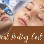 Chemical Peel