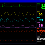 ICU Monitor