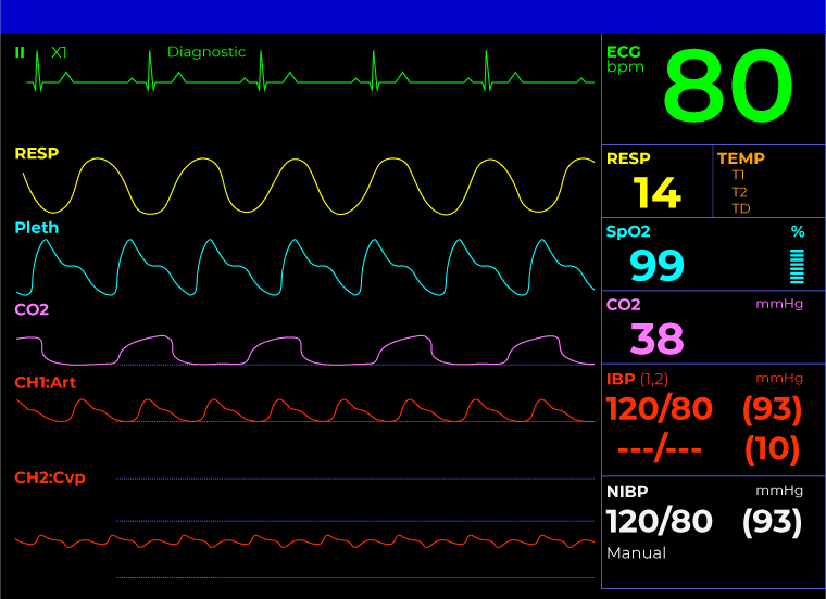 ICU Monitor